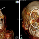 Two images showing areas where the deceased mummy was healed in life.